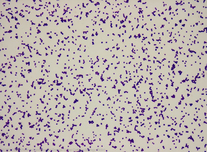 Staphylococcus epidermidis before the primary stain