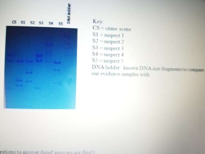 Suspect electrophoresis transcribed