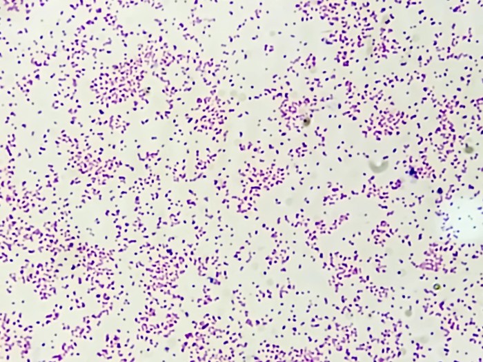 Staphylococcus epidermidis before the primary stain